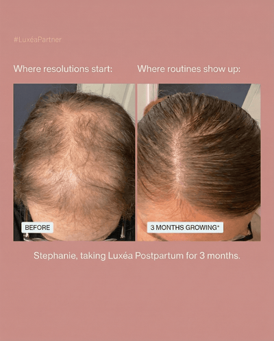 Luxea - The #1 Natural Solution for Thicker, Fuller Hair